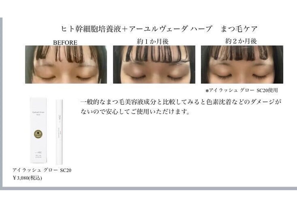 髪・頭皮ケア