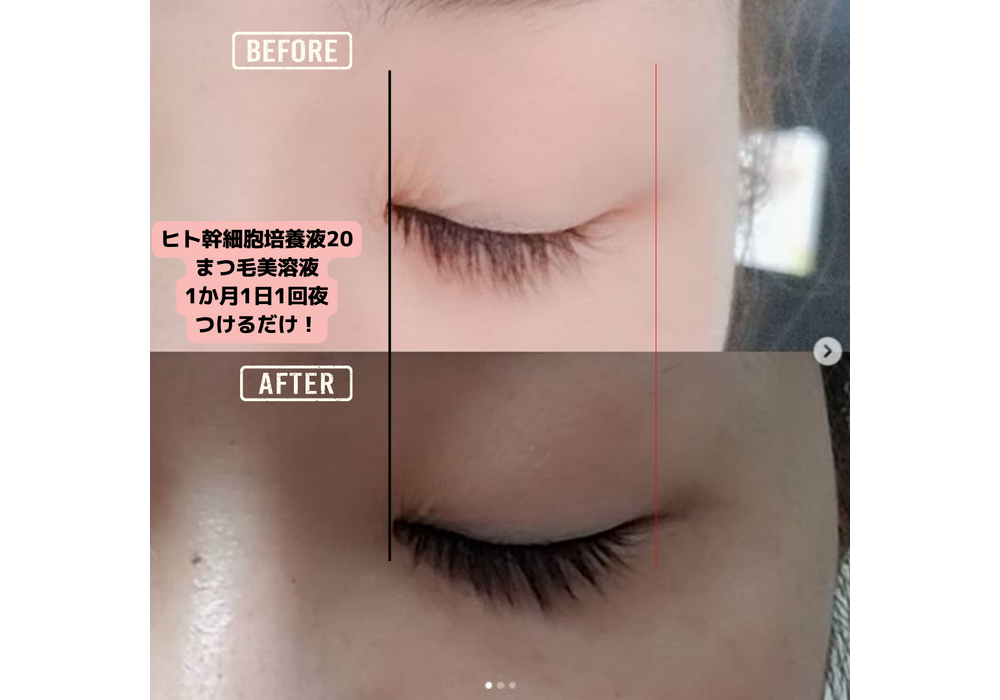 髪・頭皮ケア