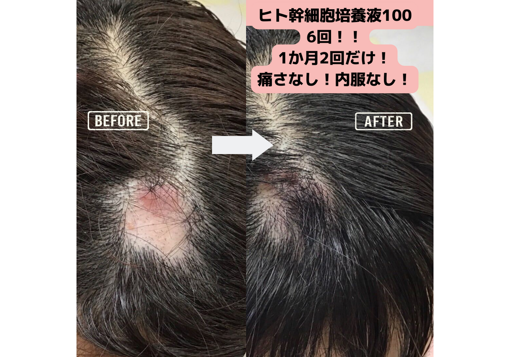 髪・頭皮ケア