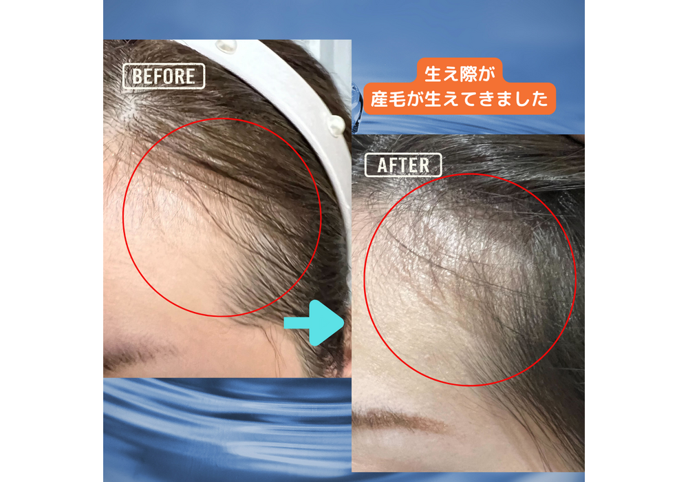 髪・頭皮ケア
