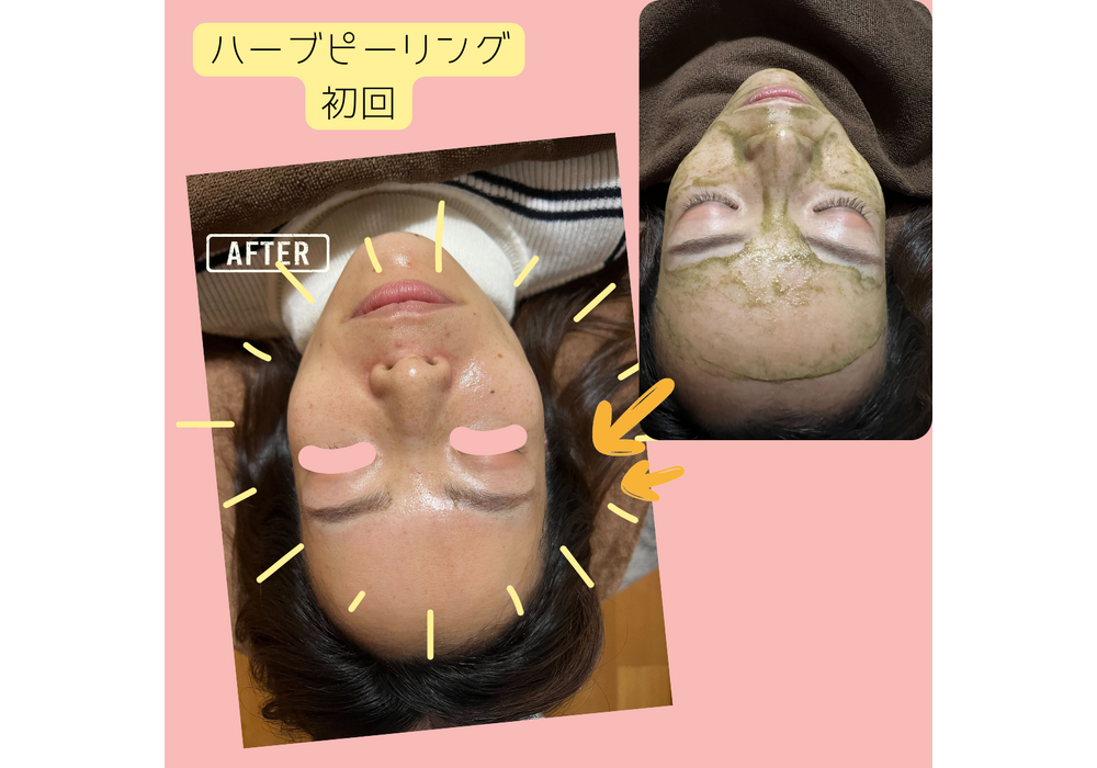 フェイシャル