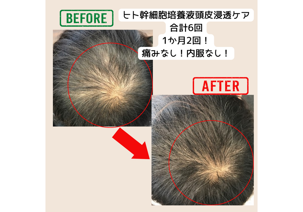 髪・頭皮ケア