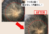 髪・頭皮ケア