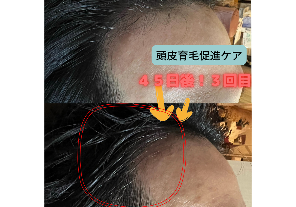 髪・頭皮ケア