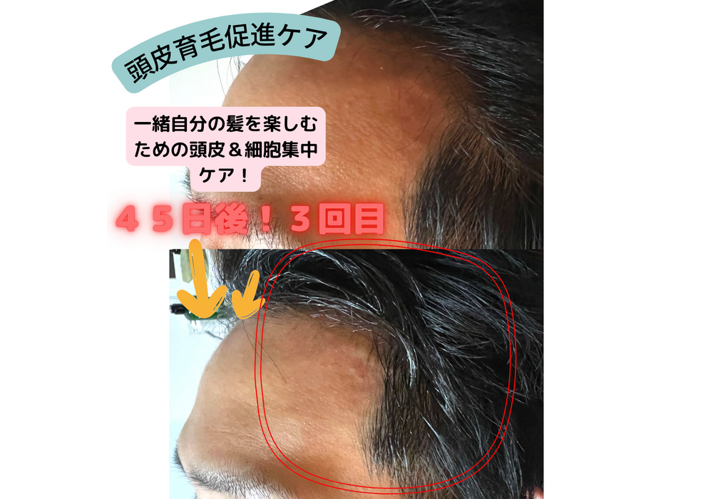 髪・頭皮ケア