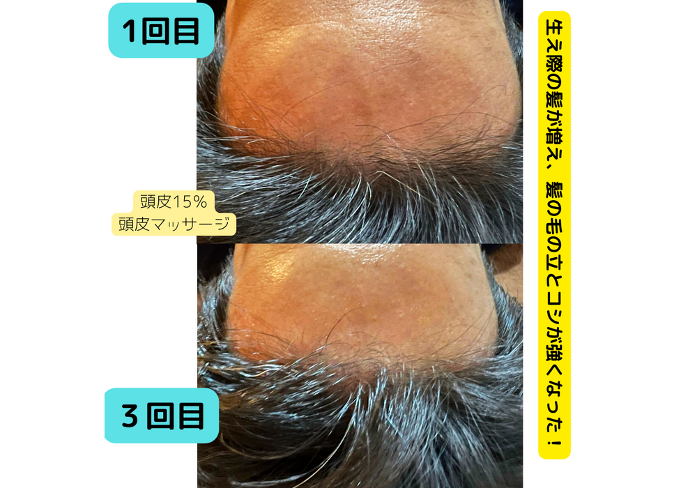 髪・頭皮ケア