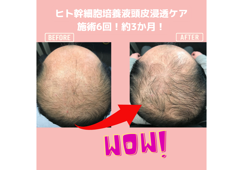 髪・頭皮ケア