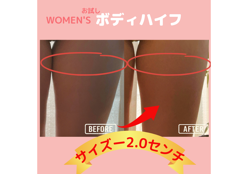 ボディハイフ