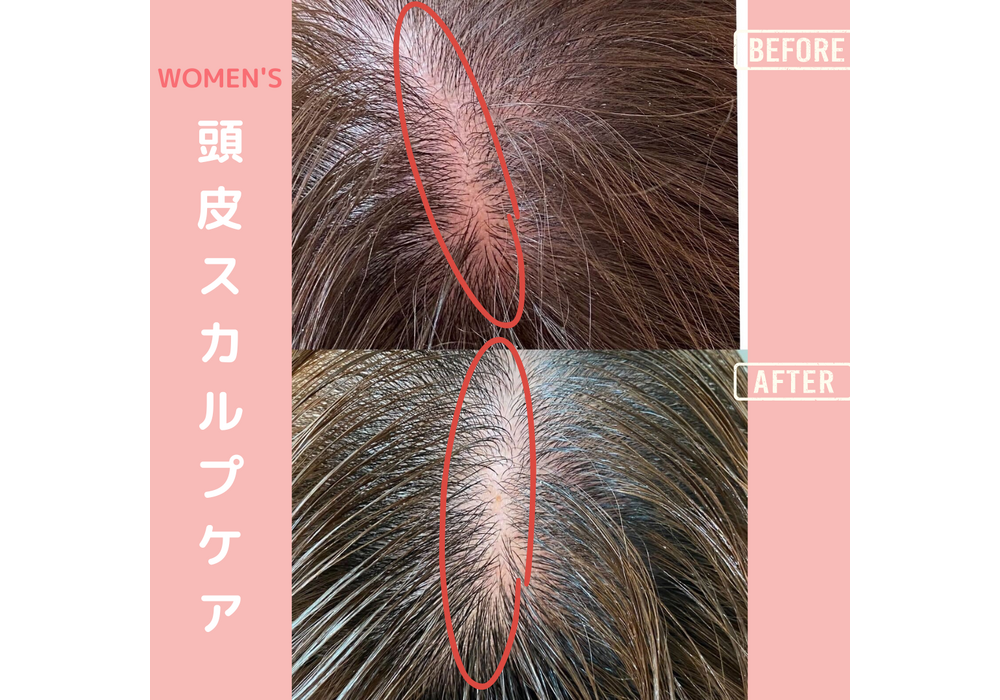 髪・頭皮ケア