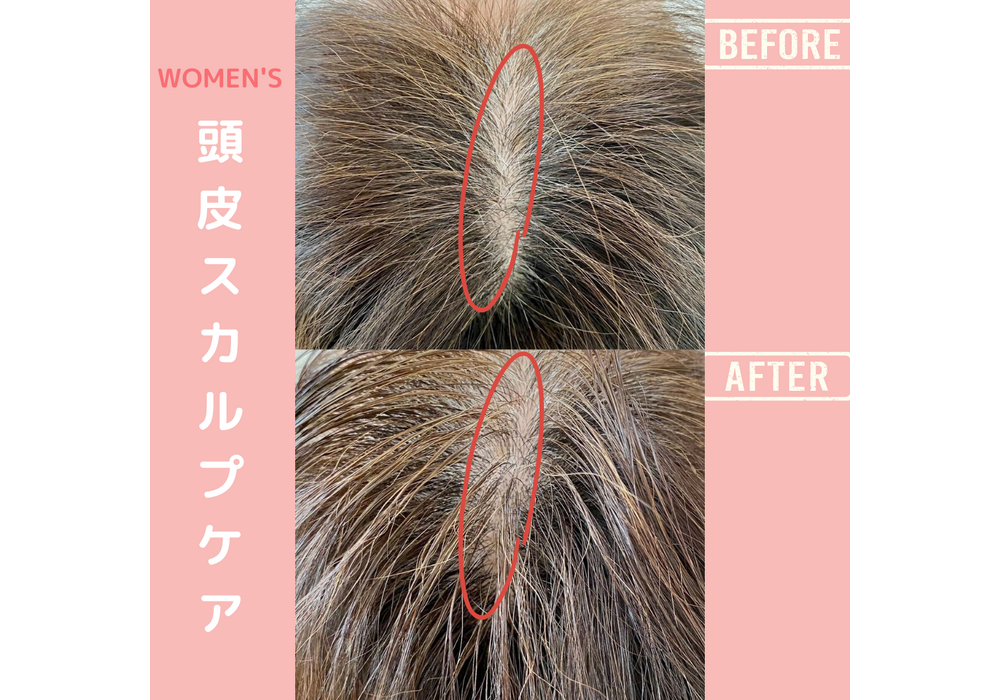 髪・頭皮ケア
